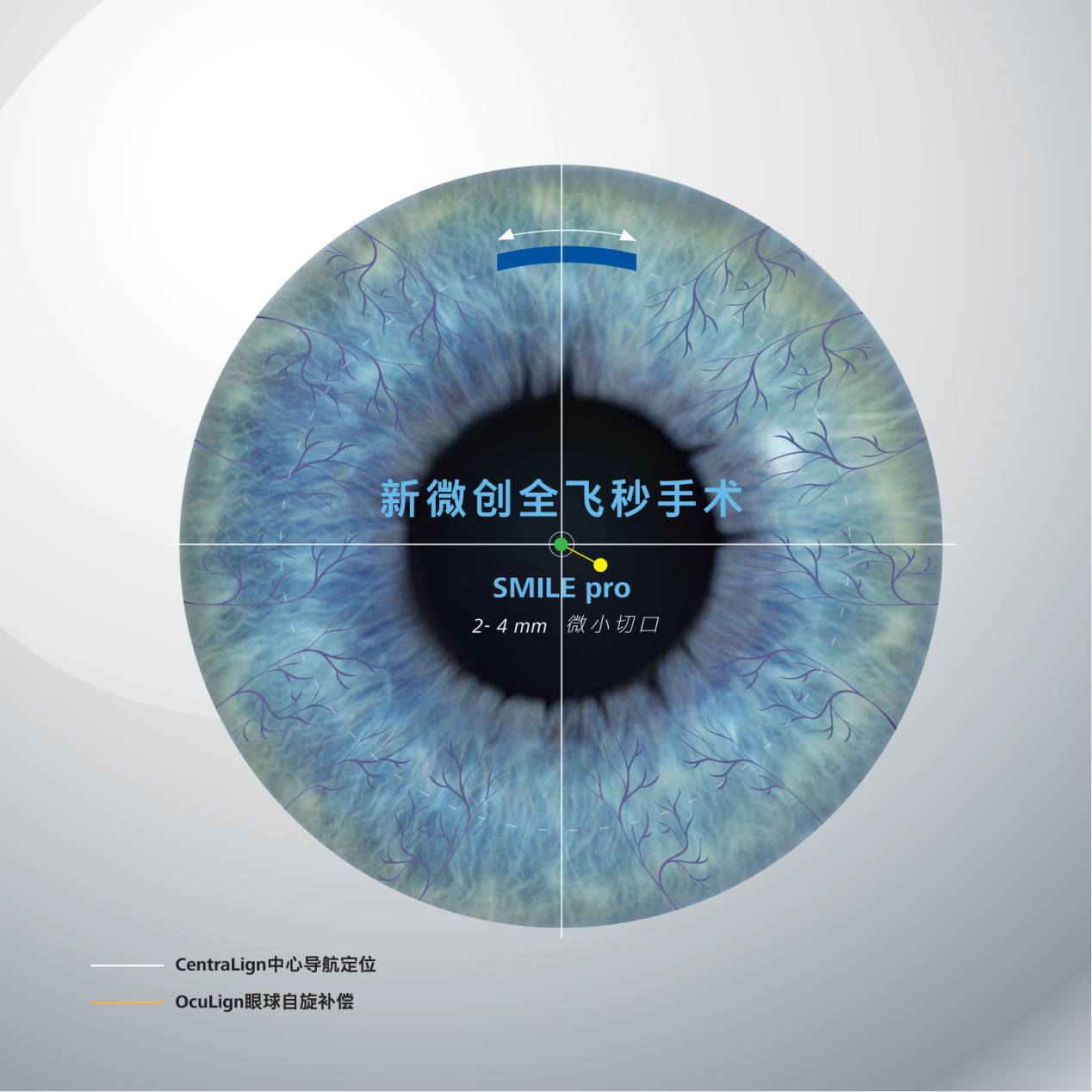 爱尔眼科完成首批VISUMAX800设备装机、首例SMILEPro近视手术(图2)